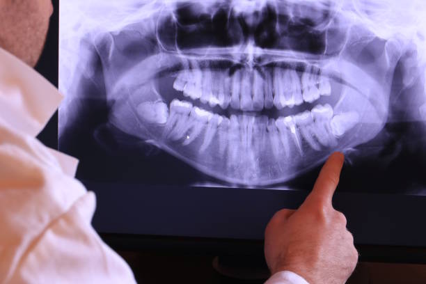 Best Emergency Denture Repair in Lehi, UT
